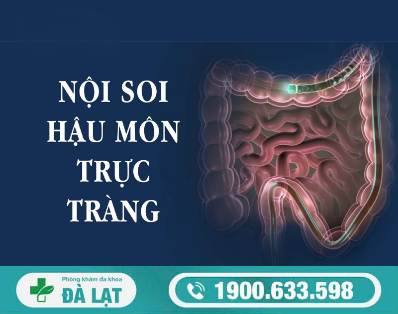 CHI PHÍ NỘI SOI HẬU MÔN – TRỰC TRÀNG HẾT BAO NHIÊU?